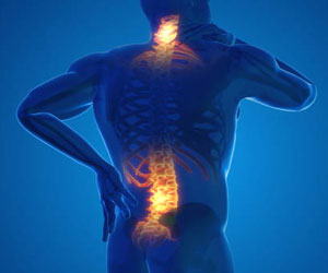 A self healing solution for back pain: Plasma therapy